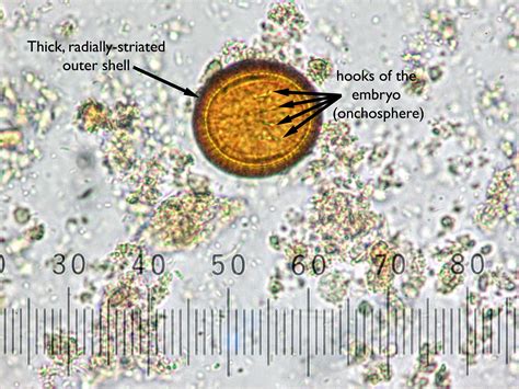 Taenia Solium Eggs