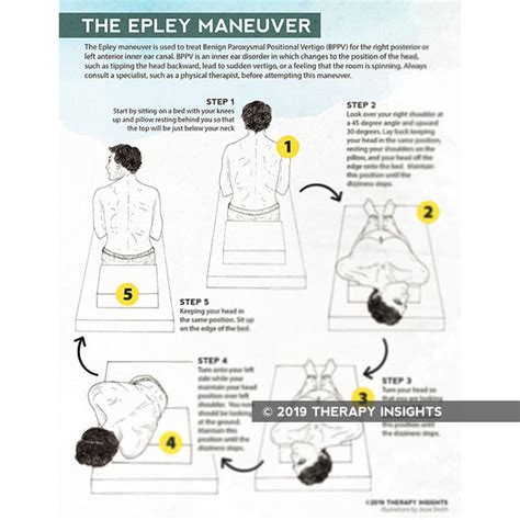 Get Epley Maneuver Steps With Pictures Pics