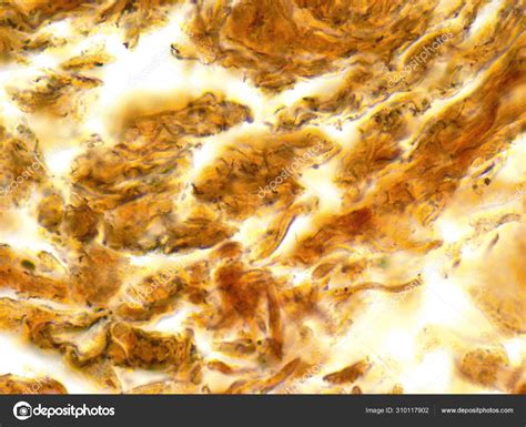 Treponema pallidum syphilis bacterium under microscope. Stock Photo by ©IvanM77 310117902