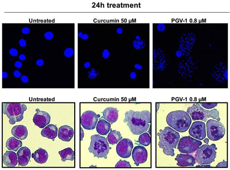 Stressing cancer with spice｜NARA Institute of Science and Technology