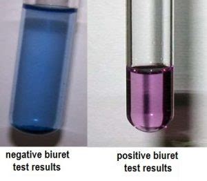 Biuret test-Principle, Requirements, Reagents, Preparation, Procedure and Result - Online ...