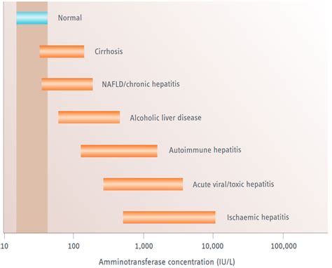 Mistakes In Liver Function Test Abnormalities And How To Avoid