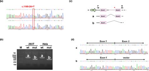 Analysis of pcDNA3.1 vector assay for the NR0B1 variant (c.1169‐2A>T):... | Download Scientific ...