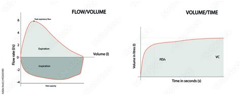 Normal Spirometry curves. Graph of volume time and of peak expiratory ...