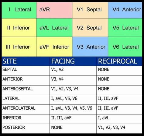 12 Lead Ekg Interpretation Cheat Sheet | Cheat Sheet