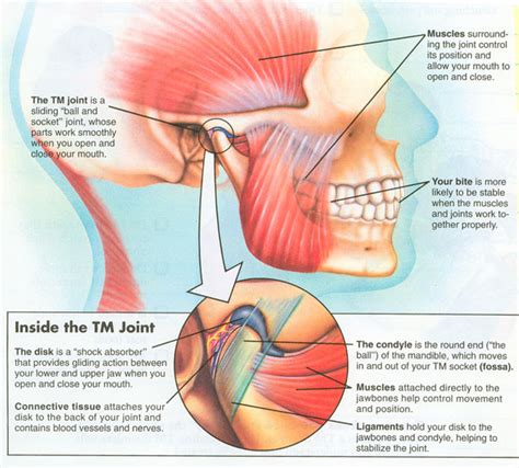 Temporomandibular Joint Disorder Treament | Dr Tim Poate, London