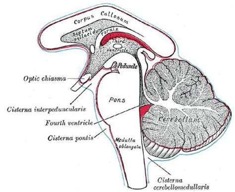 Subarachnoid cisterns | Radiology Reference Article | Radiopaedia.org ...