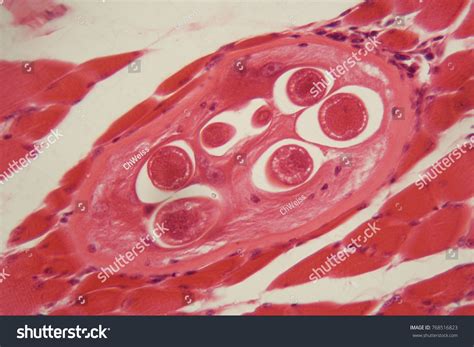 Trichinella Spiralis Larvae Muscle Tissue Under Stock Photo 768516823 ...