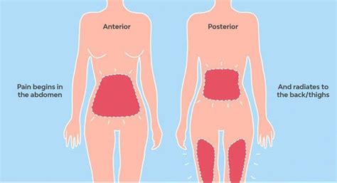 Gaining Relief From Back Pain During Menstrual Cycle