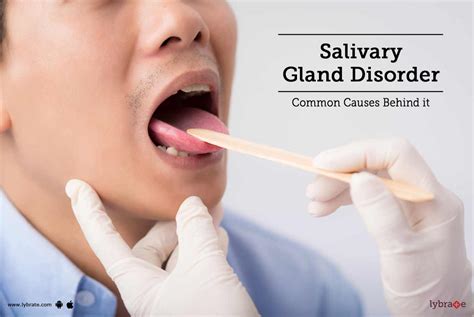 Salivary Gland Disorder - Common Causes Behind it - By Dr. Jagdish ...