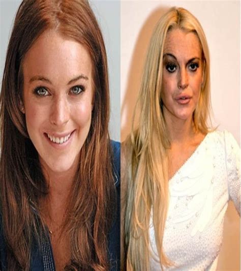 60 Worst Cases Of Celebrity Plastic Surgery Gone Wrong