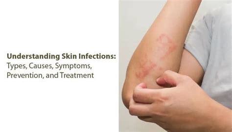 Understanding Skin Infections: Types, Causes, and Treatment