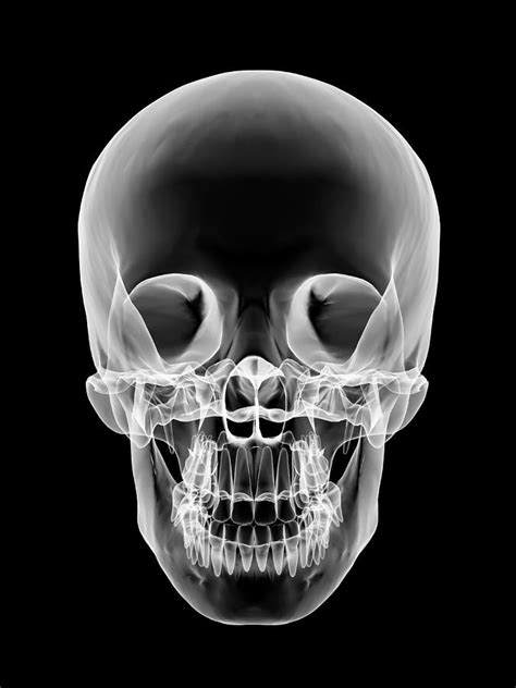 Human Skull, X-ray Artwork Photograph by Pasieka