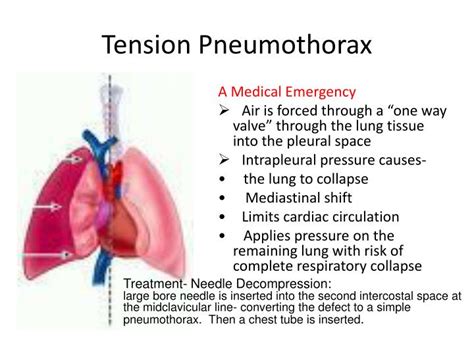 PPT - Soft Tissue Injury PowerPoint Presentation - ID:1634436