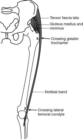 The Malalignment Syndrome | Musculoskeletal Key