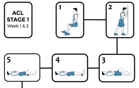 ACL: 7 tips to make recovery from ACL surgery easier - Dr Colvin Perth