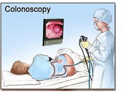 Colonoscopy - Procedure, Preparation, Test, Risks | Diseases Pictures