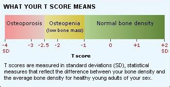 Bone Density (DEXA) - Peninsula Imaging