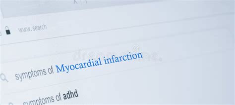 ECG. Myocardial Infarction on ECG, Subendocardial Ischemia in Chest Leads. Angina. Chest Pain ...