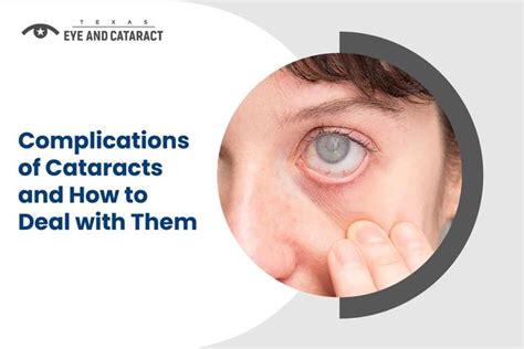 What Are The Different Types Of Cataract Surgery? How Much Do They Cost ...