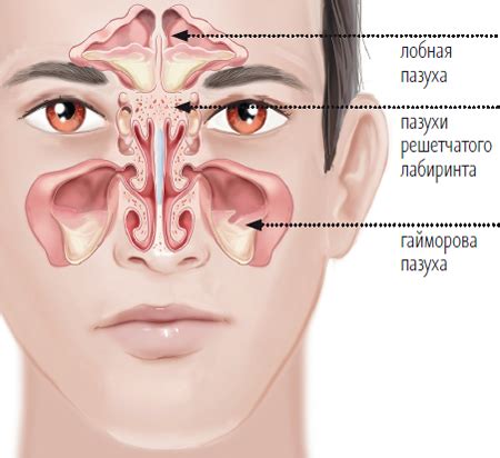 Ways of maxillary sinus cyst natural treatment. - All information about cysts