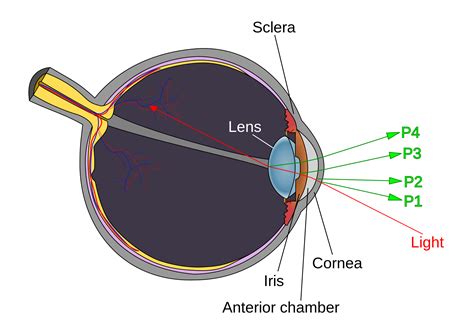 What Is Causing the Twinkle in a Patient’s Eye? | Consultant360