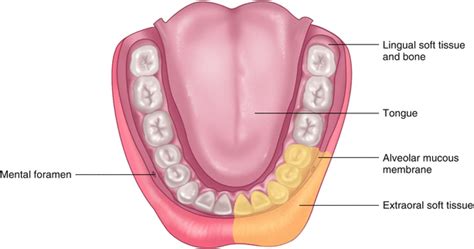 Techniques of Mandibular Anesthesia | SpringerLink