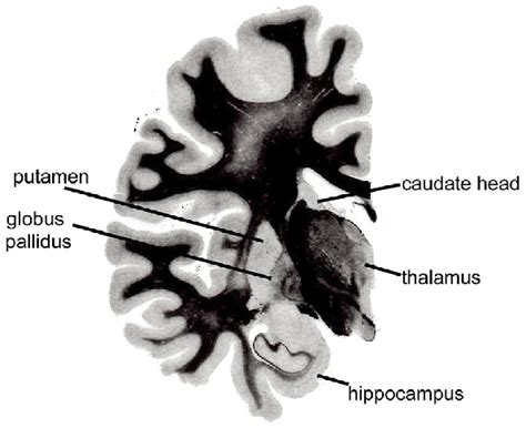 Figure3.Klüver-Barrera staining (myelin staining) of a coronal section ...