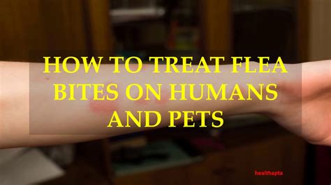 HOW TO TREAT FLEA BITES ON HUMANS AND PETS - YouTube