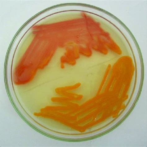 (PDF) Urinary tract infection due to Chryseobacterium gleum, an uncommon pathogen