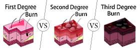 Third Degree Burns | Difference Between | Descriptive Analysis and Comparisons