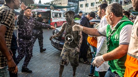 Gaza Hospital Inundated With Wounded Patients - The New York Times