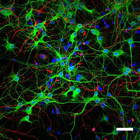 Primary Hippocampal Neuronal Cultures | Spot On Micro