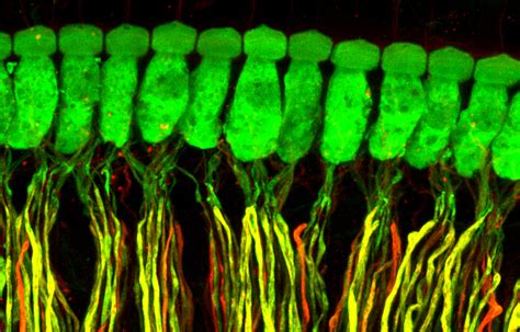 RNA-Seq identifies molecularly distinct subtypes of neurons that encode ...