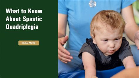 What to Know About Spastic Quadriplegia