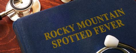 Can Dogs Get Rocky Mountain Spotted Fever from Humans?