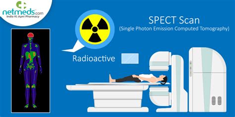 SPECT Scan: Procedure, Risks And Results