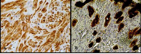 Salivary Gland Dog | saliva