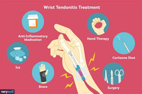 Signes, causes et traitements de la tendinite du poignet