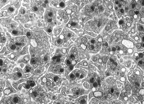 Cytoplasm Microscope