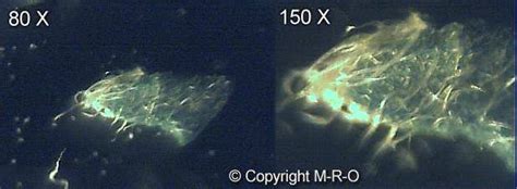 Morgellons Skin-Infection-Process by Fibers and Biofilm