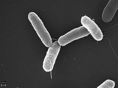 Enterobacterias: Escherichia, Shigella, Salmonella. - AnSRo