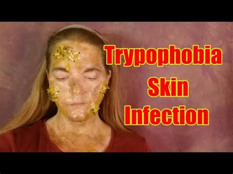 Trypophobia Makeup with Maggots - Beginner Friendly Tutorial Using Homemade Scar Wax - YouTube