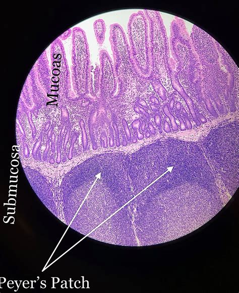 Peyer's Patch Histology.