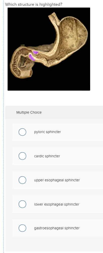 Solved Which structure is highlighted? Multiple Choice | Chegg.com