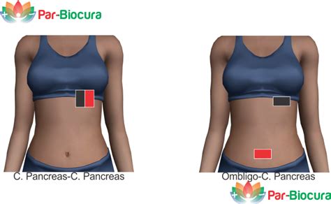 Pancreatitis aguda | Par-Biocura