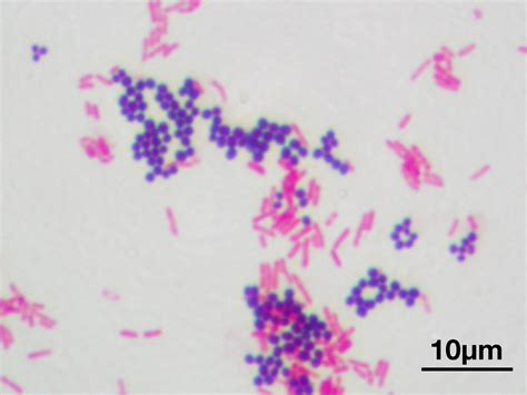 Micrococcus Luteus Capsule Stain Results - Duane Pickrell Kapsels