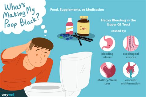 What Are the Causes of Black Stool? | Black stool, Black, Digestive health