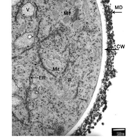 Light micrographs of (A) primary hyphae with dichotomous branches which ...