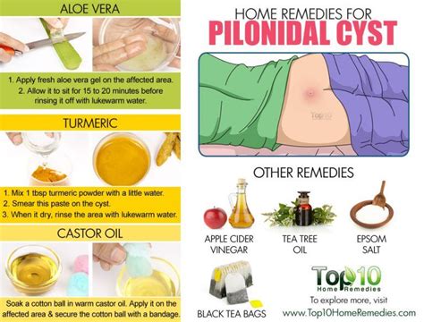 Home Remedies for Pilonidal Cysts (Large Pimple at Bottom of Tailbone ...